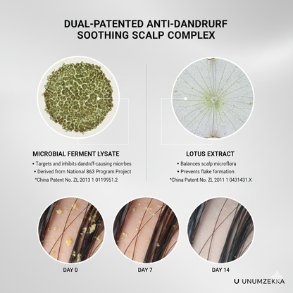 UNUMZEKKA Anti-Dandruff Oil-Control Shampoo