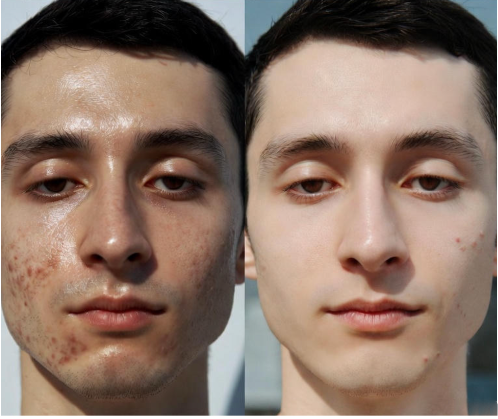 UNUMZEKKA Complete 3-Step Skincare System SET