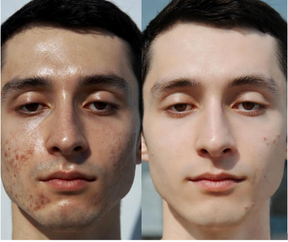 UNUMZEKKA Complete 3-Step Skincare System SET